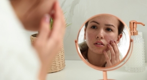Topicals Launches Acne-Scar Skincare Treatment