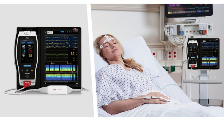 Masimo SedLine Study Finds Potential to Improve Certain Types of Sedation