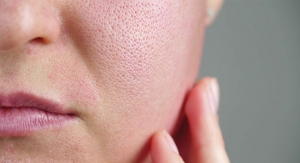 Two Novel Natural Extracts Improve Pore Appearance