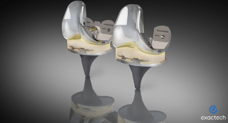 Exactech Completes First Surgeries with TriVerse Primary Knee