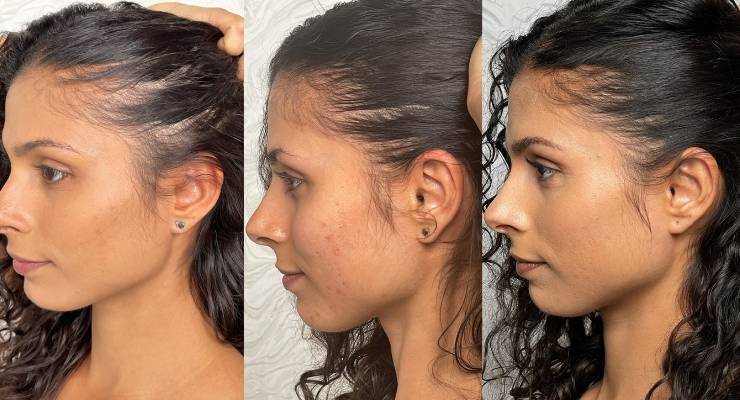 Nulastin Unveils Hair Growth Outcomes from Pair of Studies
