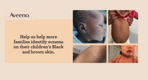 Aveeno Baby Addresses Lack of Resources about Eczema in Black and Brown Skin