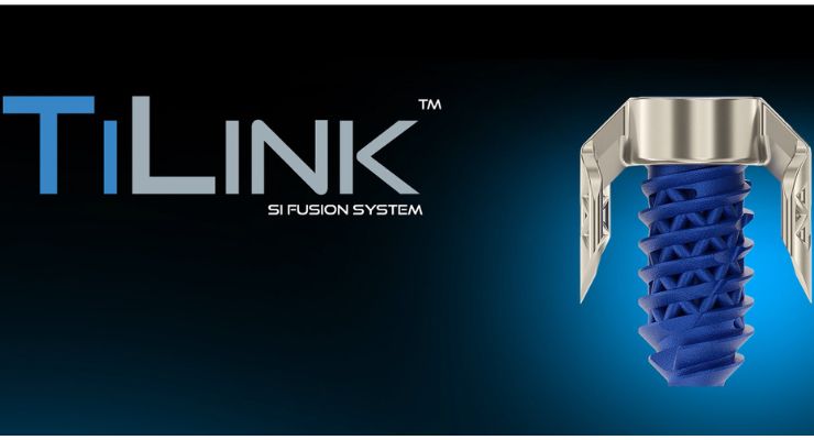 SurGenTec Introduces TiLink-P Sacroiliac Joint Compression Implant