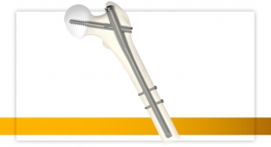 Stryker Augments Gamma4 Hip Fracture Nailing System