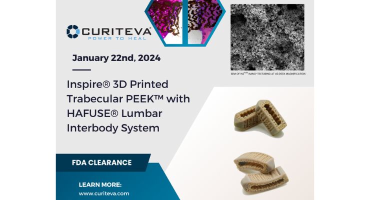FDA Clears Curiteva’s Inspire 3D Printed Trabecular PEEK Lumbar Interbody Fusion System