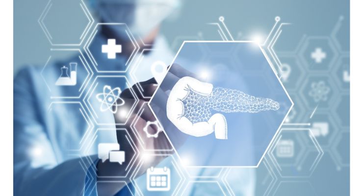 Researchers Detect Pancreatic Cancer with Machine Learning Models