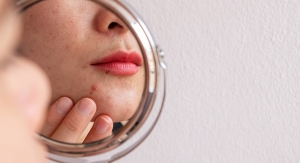 American Academy of Dermatology Issues Updated Guidelines for Acne Management 
