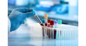 Researchers Find Blood Test Perform as well as Approved Spinal Fluid Test in Detecting Alzheimer