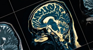 PharmaKure Partners with Sheffield Hallam University to Better Understand Alzheimer’s