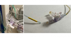 Medtronic Has a Class I Catheter Tubing Recall