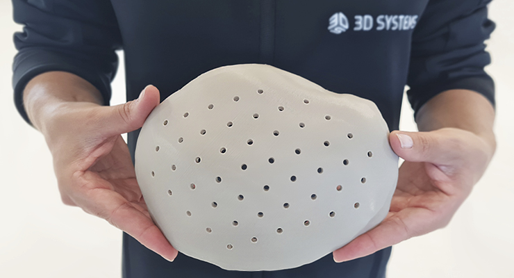 Boost Mobility: Precision Joint Replacement with 3D-Printed Implants