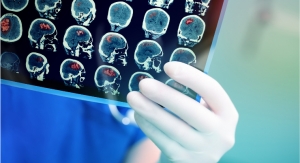 AI, Imaging Agents, Ultrasound Tech Helping to Advance Diagnostic Imaging