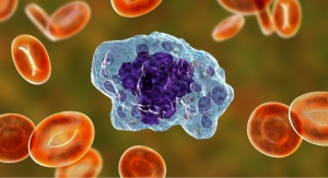 Wellmune Postbiotic Supports Innate Immune Function: In Vitro Study 