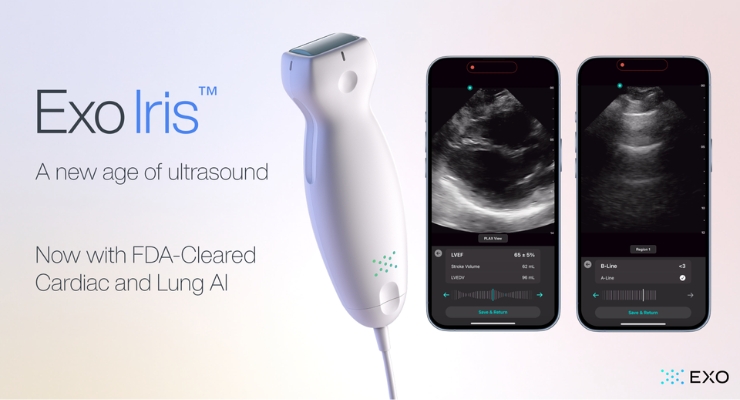 Exo Rolls Out AI-Powered Cardiac, Lung Tools for Handheld Ultrasound