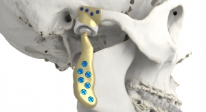 Materialise Debuts a Fully Personalized TMJ Total Arthroplasty System  