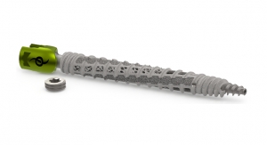 SI-BONE Launches iFuse Bedrock Granite 9.5mm Implant; Completes 1st Surgeries