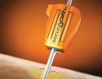 New Sizes of Interrad Catheter Cleared by FDA
