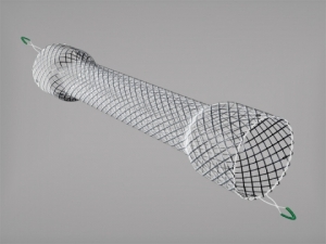 Cook Medical Initiates Clinical Study to Evaluate Stent  Removal 